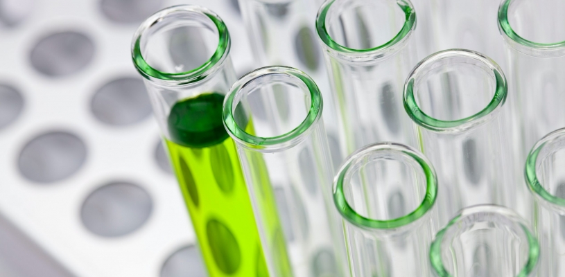 beakers in a tray with one beaker filled with green fluid