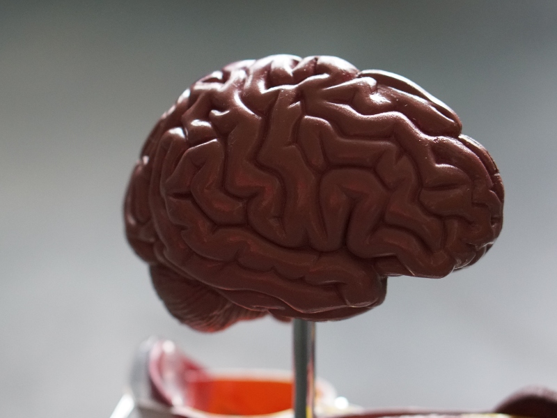 Model of a brain