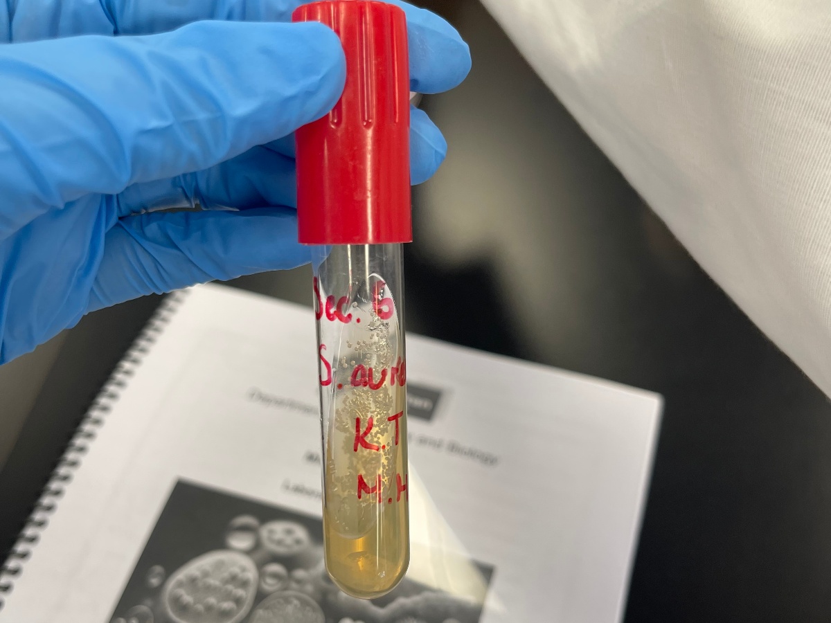 Fiza is wearing blue gloves and holding a tube with a yellow solution inside of it.