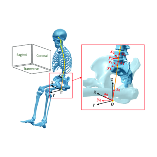3D Biomechanical Modeling for Sitting Contact Stress Analysis