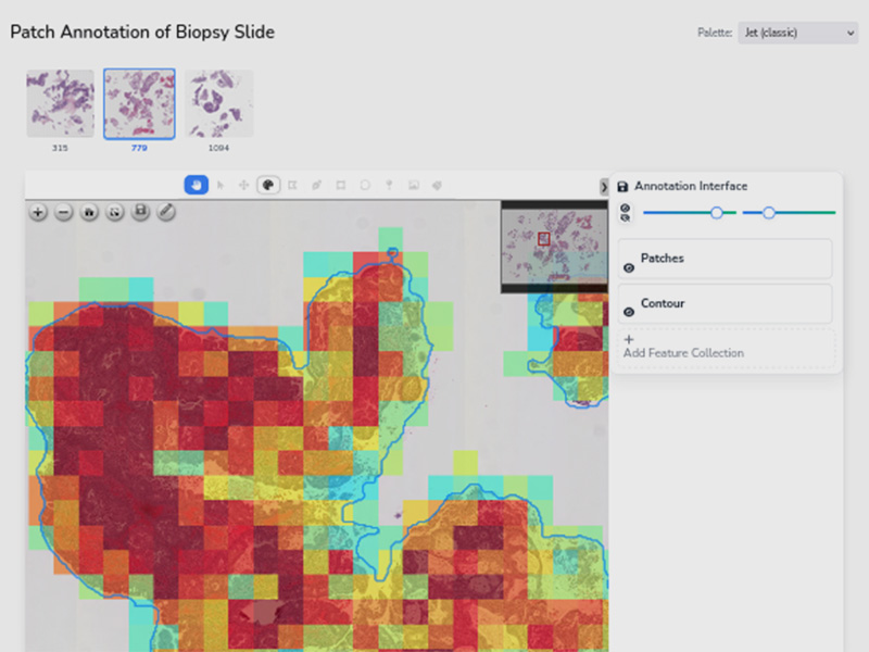 Endometrial Cancer Identification in Histopathology