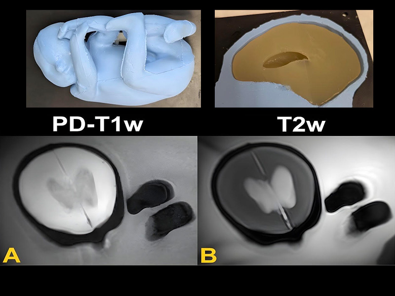 Fetal Phantom Synthesis