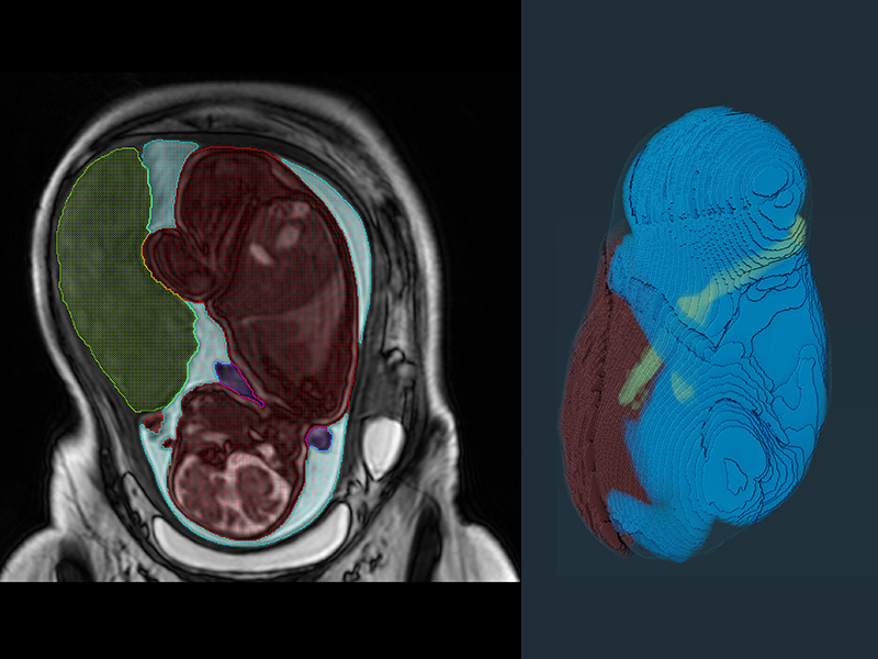 Fetal Assessment Suite (FetAS)