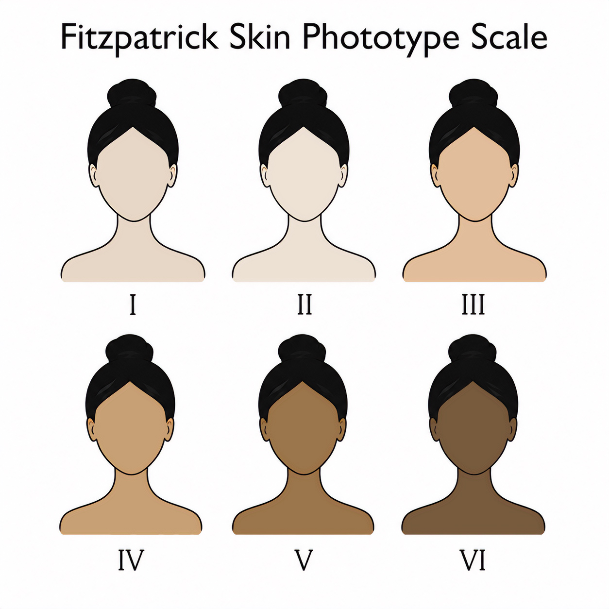 Diagram showing the concept of the Fitzpatrick scale. 