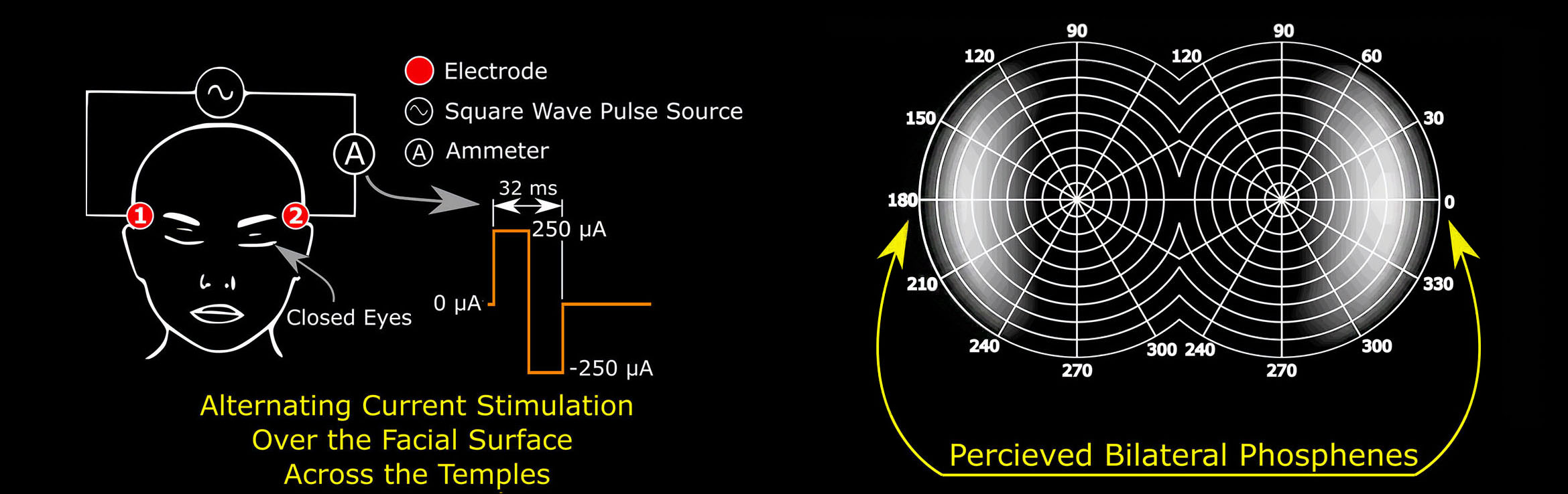 Diagram showing how electrical stimulation of the head temples produces bilateral phosphenes.  