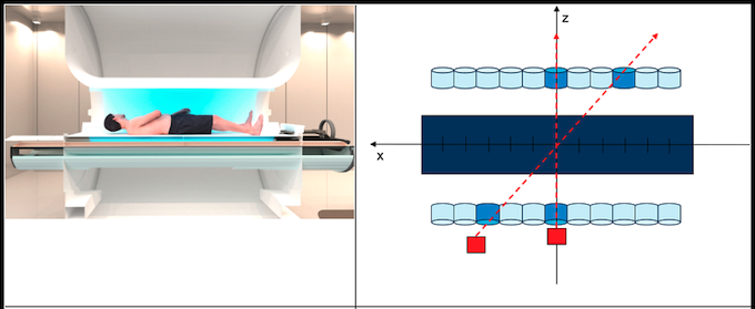 (left) Artistic rendering of patient lying in an MR-Linac machine. (right) Design of scintillator geometry.