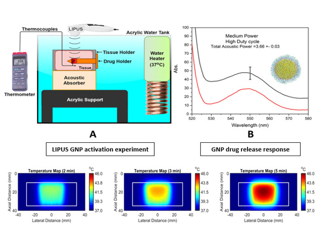  Top panel shows the LIPUS (low intensity pulsed ultrasound) experimental setup developed for GNP drug delivery and a typical result. Bottom panel show the LIPUS temperature map in the region of interest in tissue as used in the experiments.