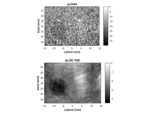 Fig 1. Experiment images using (a) Delay and Sum (DAS) and (b) Decorrelating Compounding with Time Gain Compensation (DC-TGC)