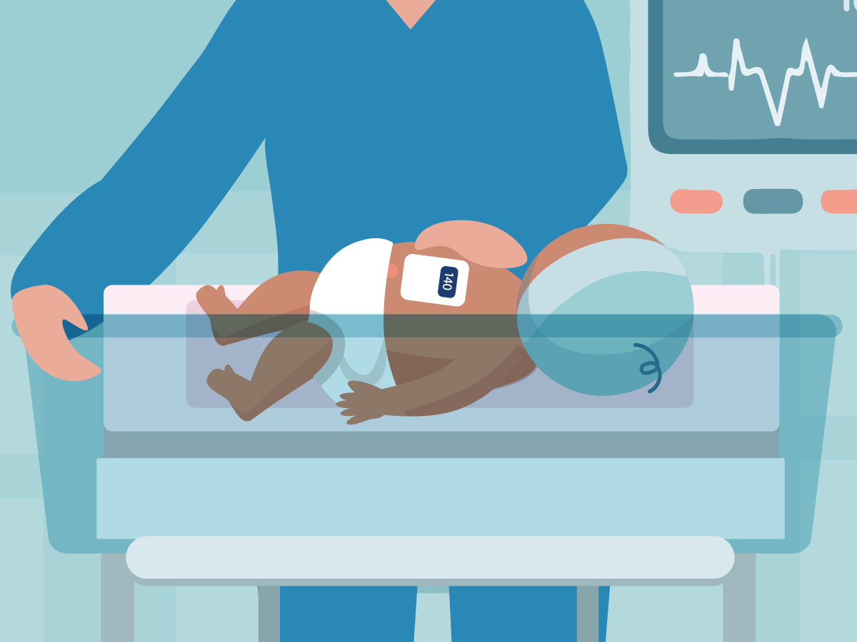 Illustration of a newborn lying on a hospital bed wearing a small wireless heart monitor on their chest, with a clinician nearby and a vital signs screen in the background.