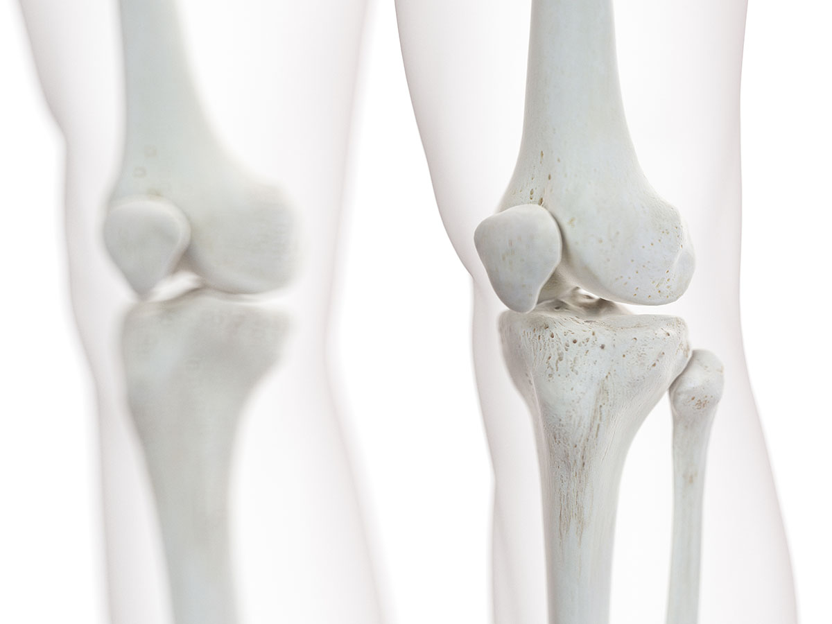 Knee bones