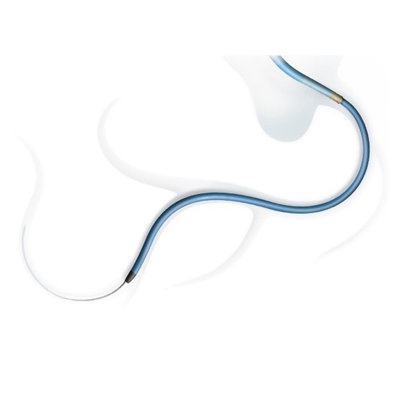 Illustration of catheter in long tortuous anatomy